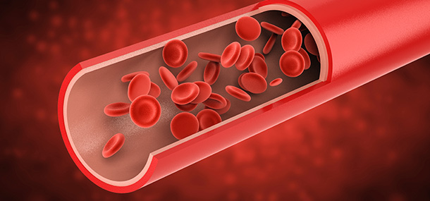 Thrombozytopenie – das erhöhte Blutungsrisiko