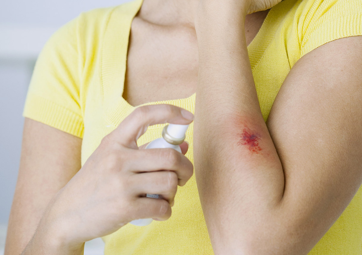 Frau versorgt ihre Wunde.