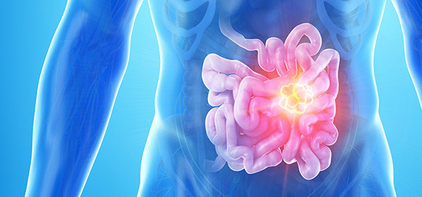 Blaue Schleife als Symbol für Darmkrebs - Aktionsmonat von KREBS & ICH.