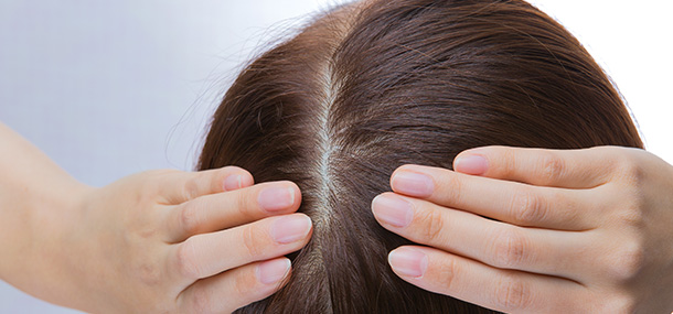 Haarausfall bei Chemo