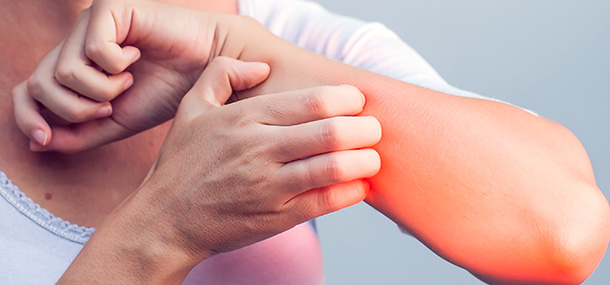 Juckende Haut bei Chemo